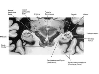 The Reticular Formation Limbic System And Basal Ganglia BrainMind.com