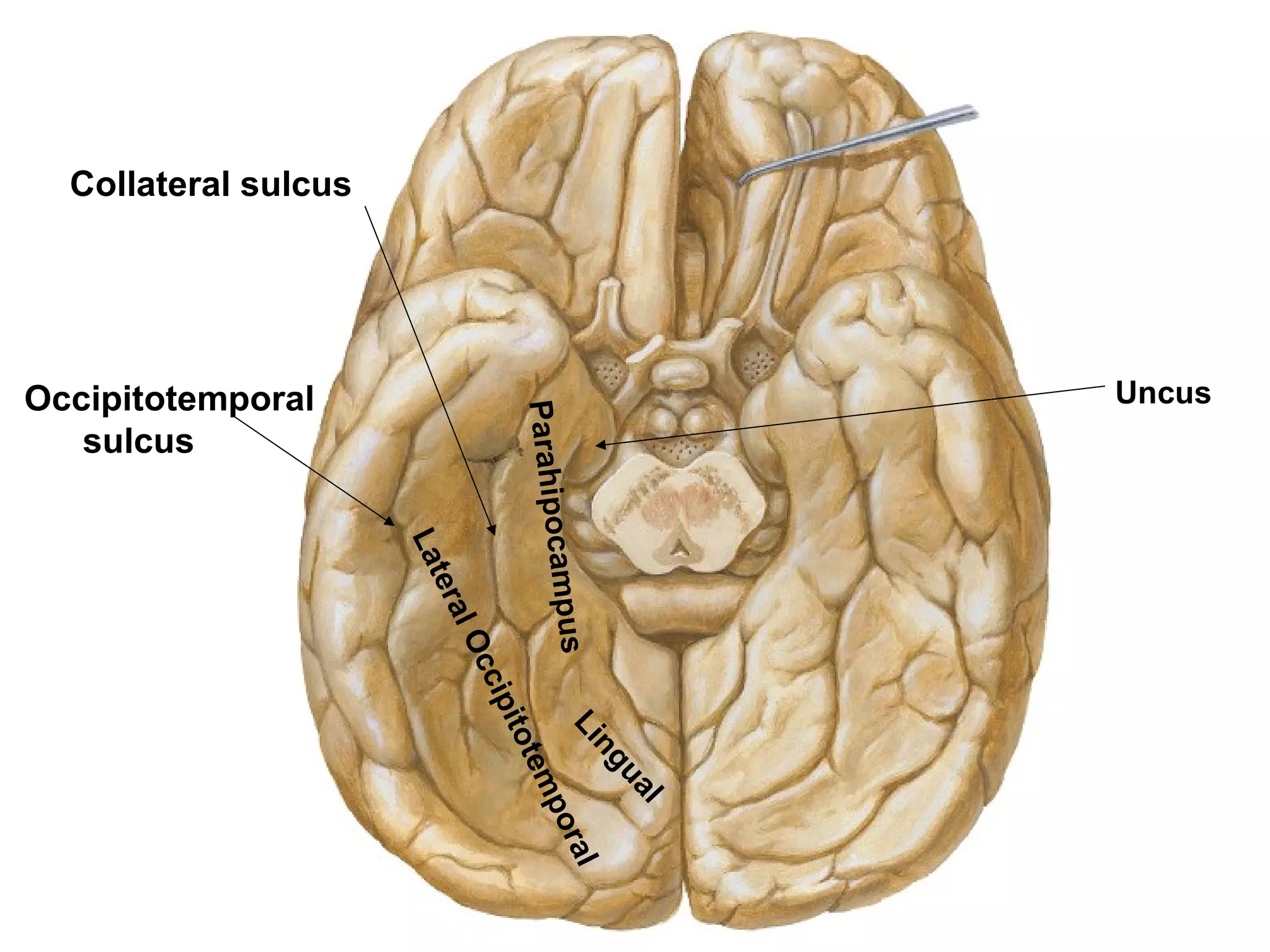 Occipitotemporal
sulcus
Collateral sulcus
ParahipocampusLingual
LateralOccipitotemporal
Uncus
 