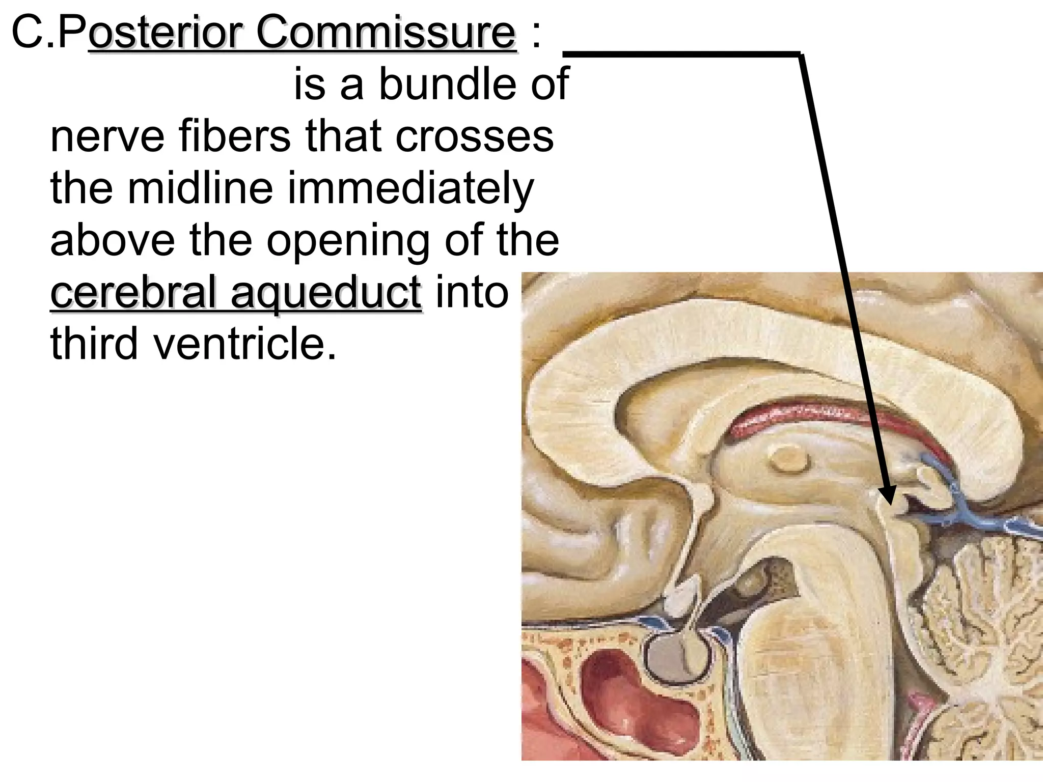C.Posterior Commissureosterior Commissure :
is a bundle of
nerve fibers that crosses
the midline immediately
above the opening of the
cerebral aqueductcerebral aqueduct into the
third ventricle.
 
