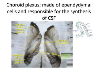 Choroid plexus; made of ependydymal
cells and responsible for the synthesis
of CSF
 