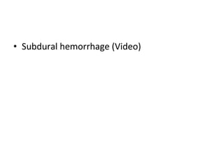 • Subdural hemorrhage (Video)
 
