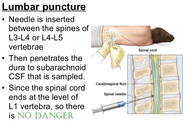 Spinal Cord And Vertebral Canal