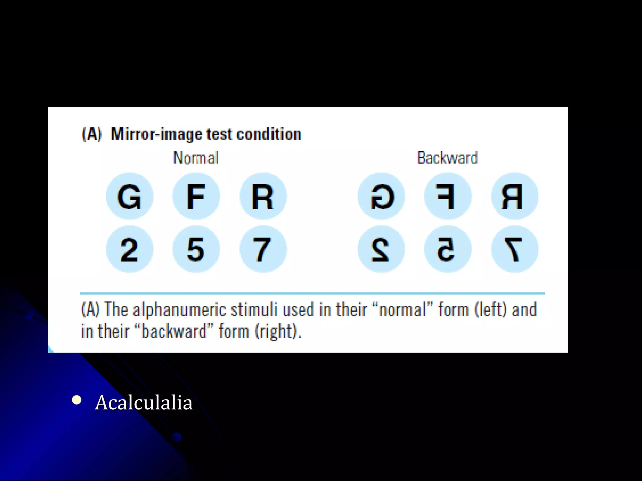  AcalculaliaAcalculalia
 