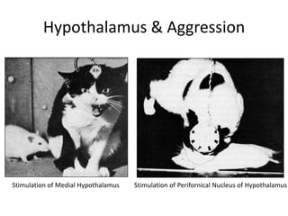 Pathophysiology: Neuroanatomy Part II | PPTX