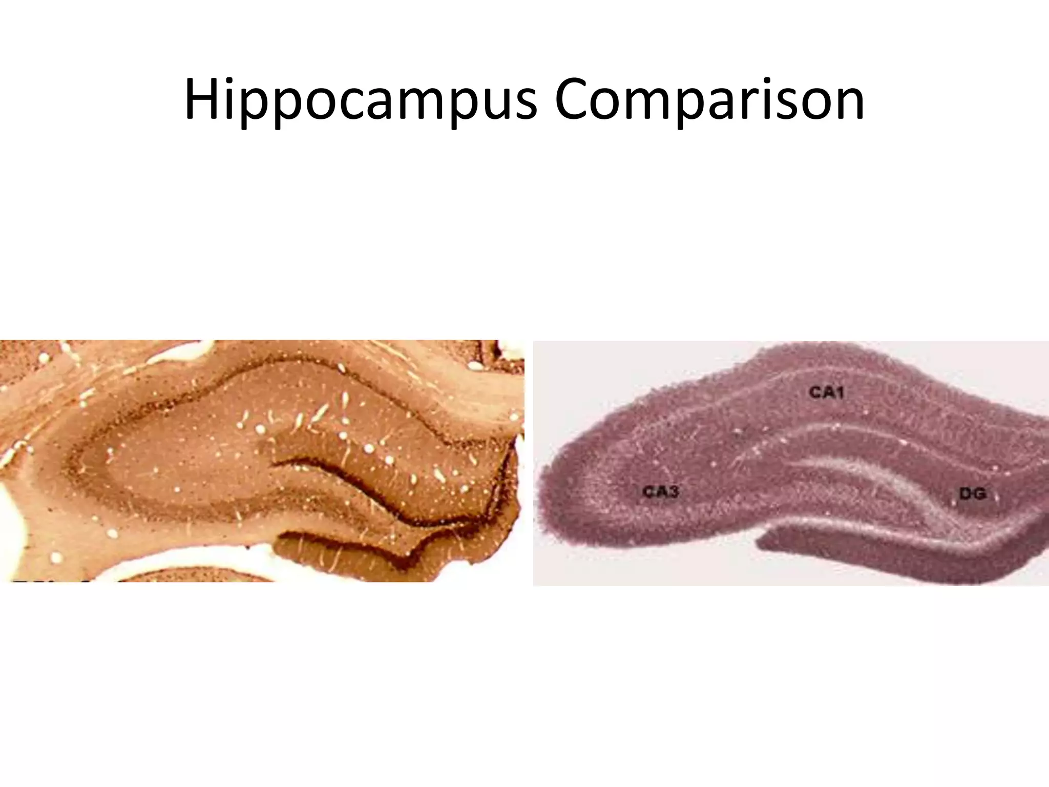 Hippocampus Comparison
 