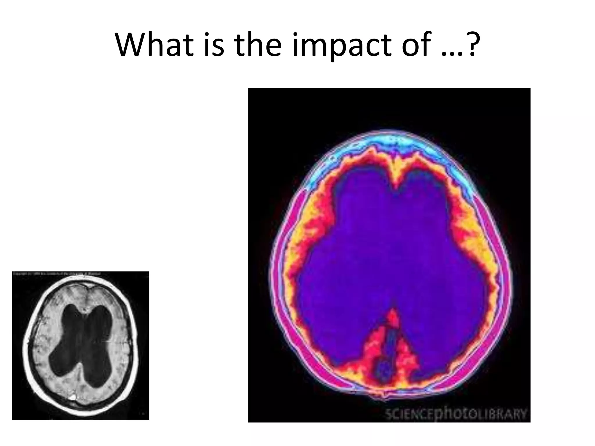 What is the impact of …?
 