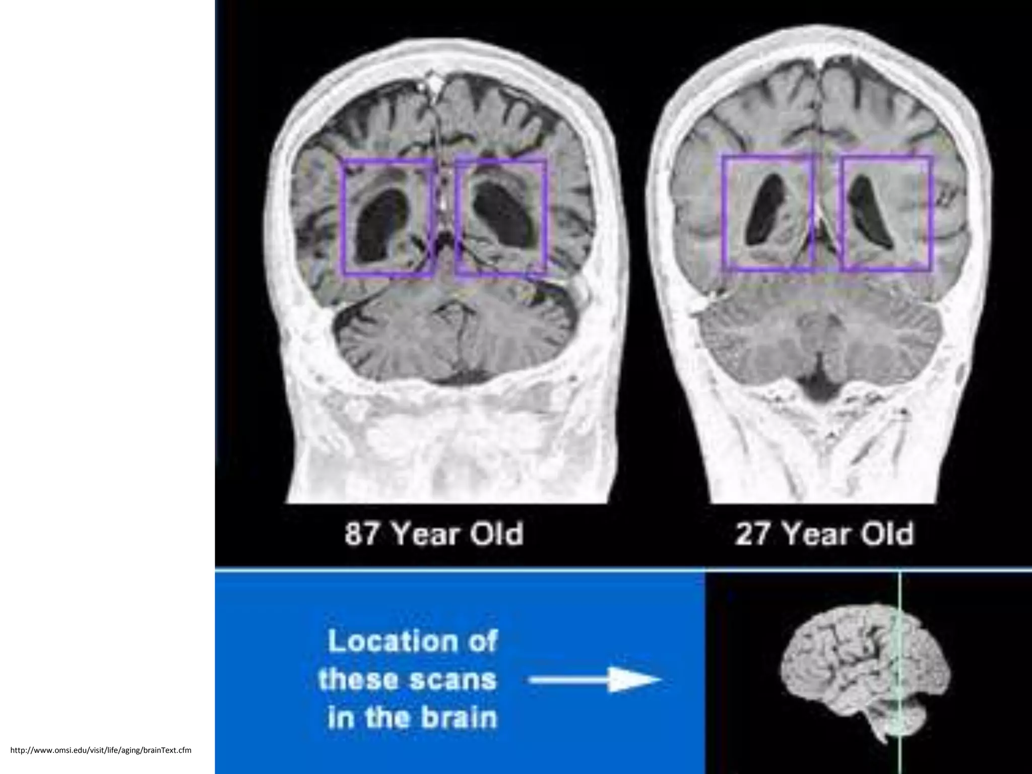 http://www.omsi.edu/visit/life/aging/brainText.cfm
 