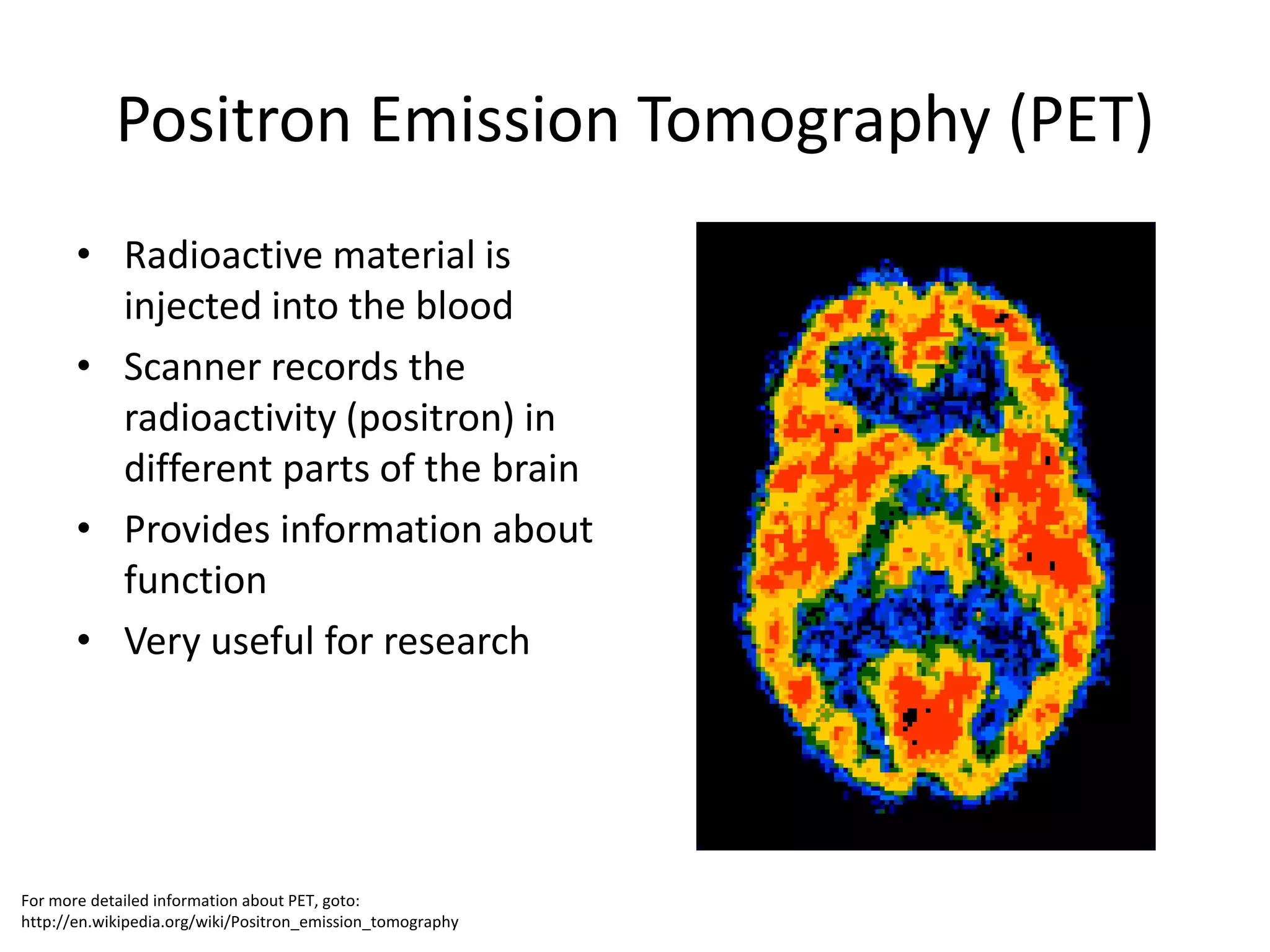 Positron Emission Tomography (PET)
       • Radioactive material is
         injected into the blood
       • Scanner records the
         radioactivity (positron) in
         different parts of the brain
       • Provides information about
         function
       • Very useful for research




For more detailed information about PET, goto:
http://en.wikipedia.org/wiki/Positron_emission_tomography
 