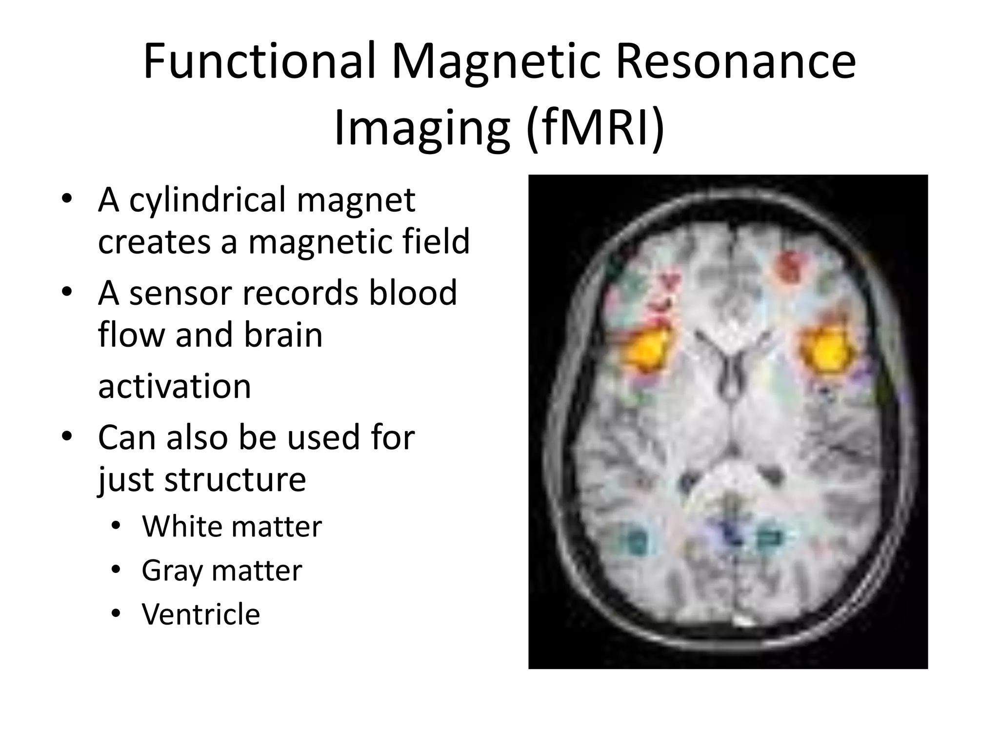 Functional Magnetic Resonance
             Imaging (fMRI)
• A cylindrical magnet
  creates a magnetic field
• A sensor records blood
  flow and brain
  activation
• Can also be used for
  just structure
   • White matter
   • Gray matter
   • Ventricle
 