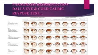 PARAGRAPH REPRSENTATION
DALLS EYE & COLD CALRIC
RESPOSE TEST…
 
