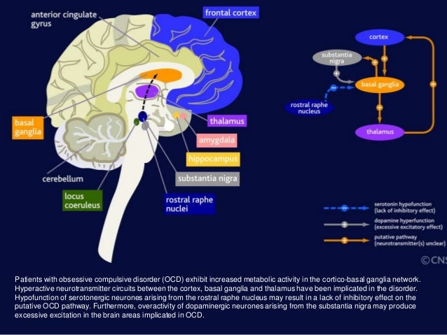 Patients with obsessive compulsive disorder (OCD) exhibit increased metabolic activity in the cortico-basal ganglia networ...