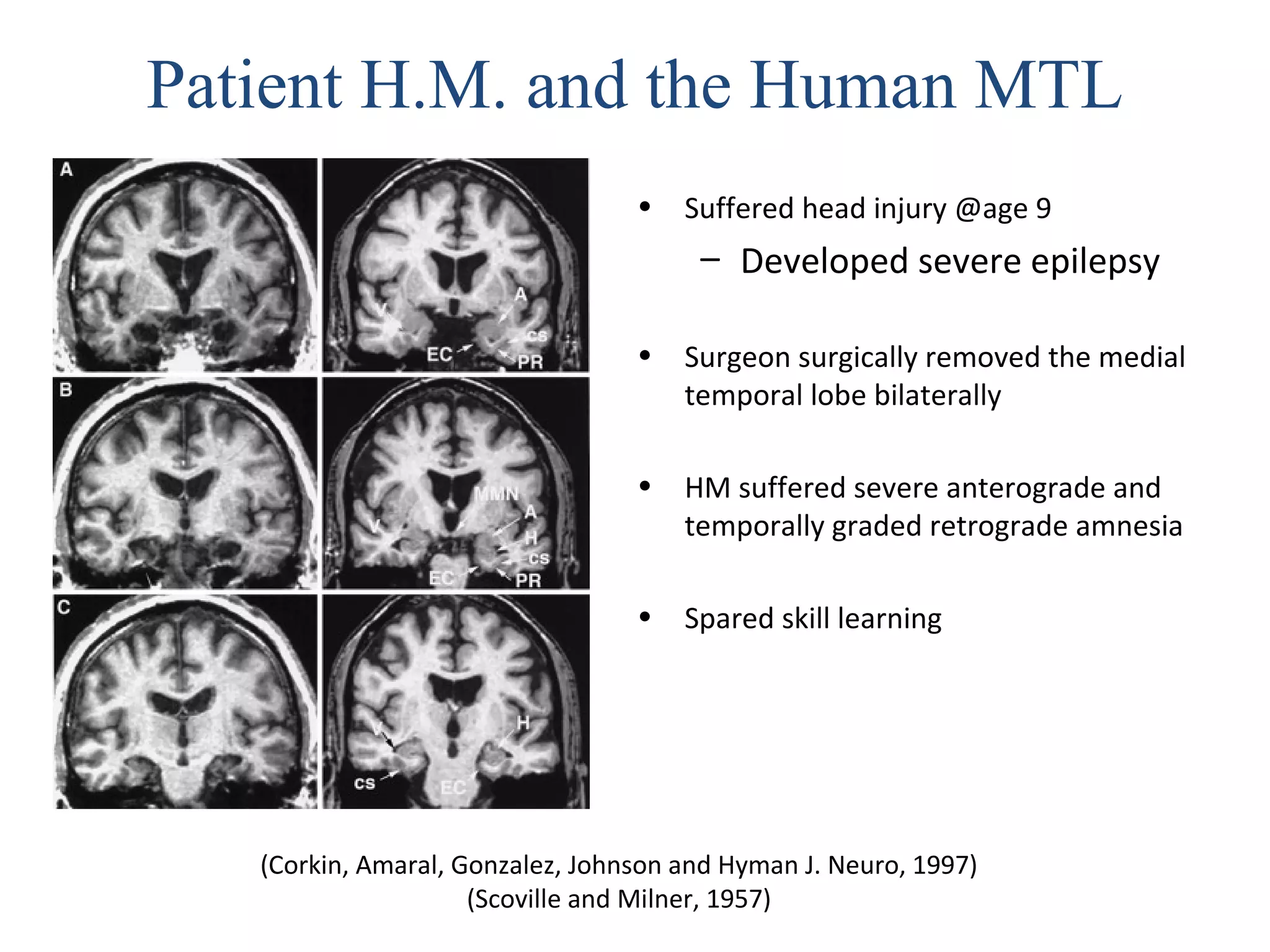 (Corkin, Amaral, Gonzalez, Johnson and Hyman J. Neuro, 1997)
(Scoville and Milner, 1957)
Patient H.M. and the Human MTL
• Suffered head injury @age 9
– Developed severe epilepsy
• Surgeon surgically removed the medial
temporal lobe bilaterally
• HM suffered severe anterograde and
temporally graded retrograde amnesia
• Spared skill learning
 