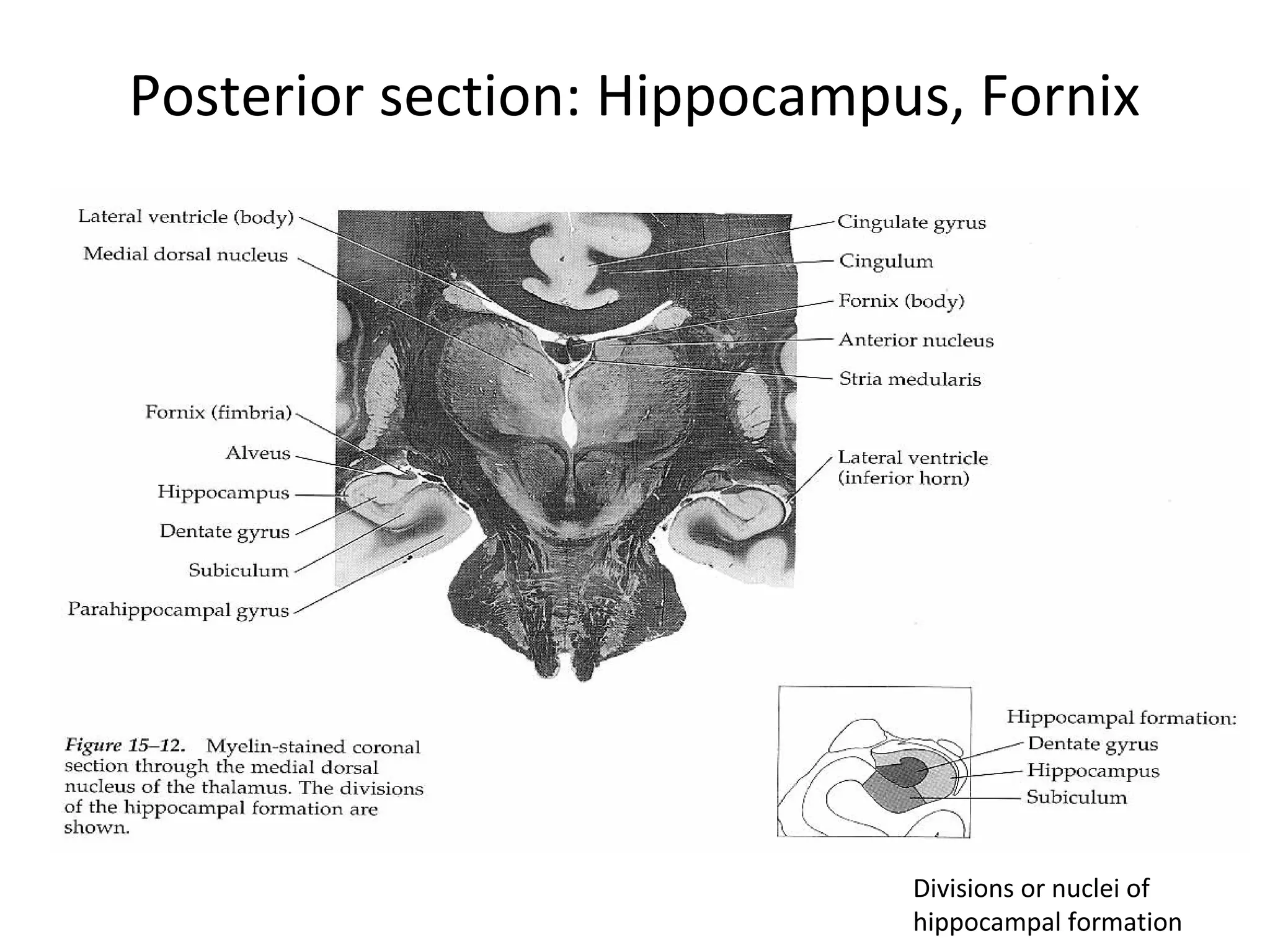 Posterior section: Hippocampus, Fornix
Divisions or nuclei of
hippocampal formation
 