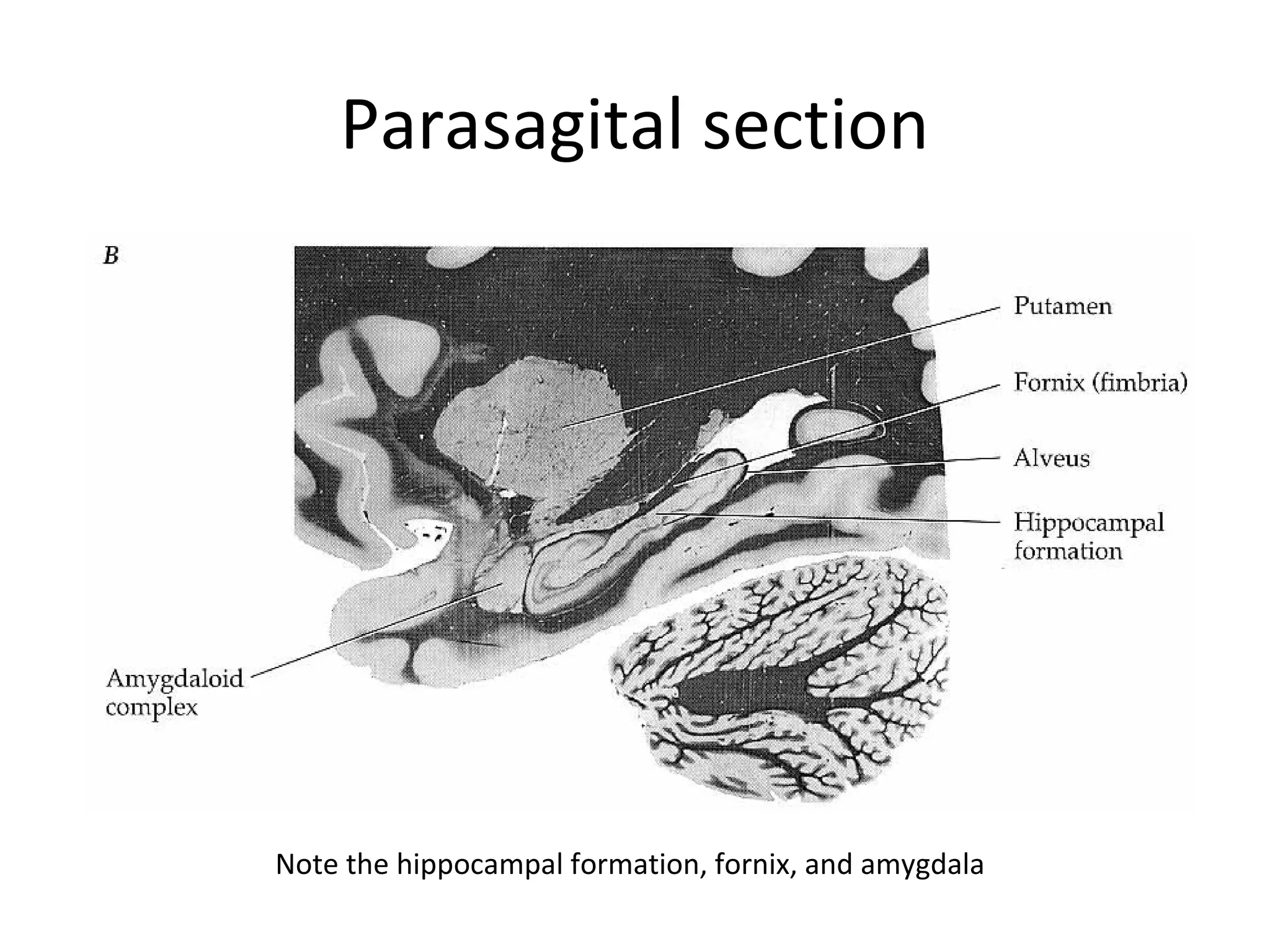 Parasagital section
Note the hippocampal formation, fornix, and amygdala
 