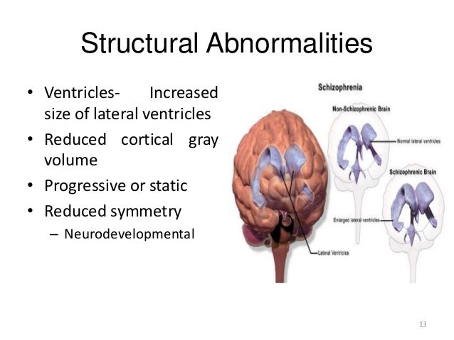 Neurobiology Of Schizophrenia