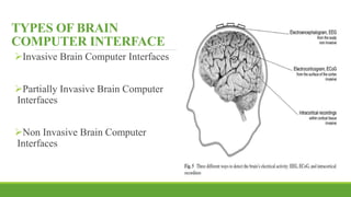 Invasive Computing Neurobionics and robotic neurorehabilitations | PPTX
