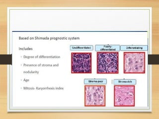Shimada Classification NEUROBLASTOMA - PAEDIATRIC COMMON TUMORS | PPTX