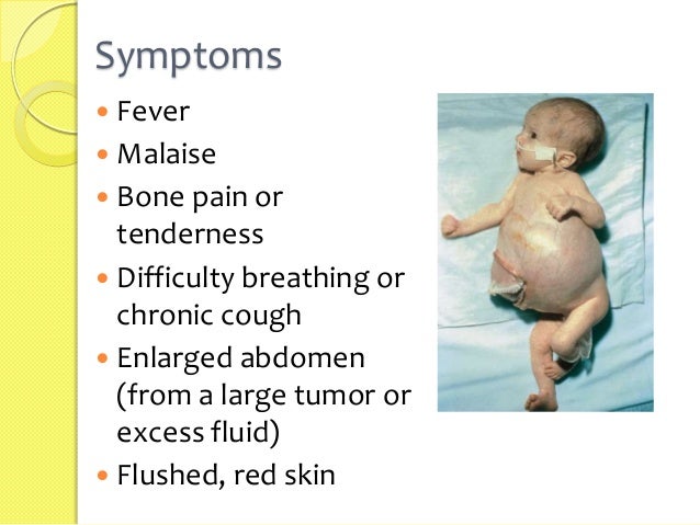 Neuroblastoma
