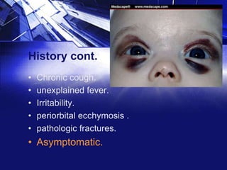 History cont.
•
•
•
•
•

Chronic cough.
unexplained fever.
Irritability.
periorbital ecchymosis .
pathologic fractures.

• Asymptomatic.

 