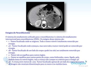Estágios do Neuroblastoma
O sistema de estadiamento utilizado para o neuroblastoma é o sistema de estadiamento
internacional para neuroblastoma (INSS). Os estágios desse sistema são:
• 1 - Tumor localizado onde se originou. Todo o tumor visível é totalmente removido por
cirurgia.
• 2A - Tumor localizado onde começou, mas nem todo o tumor visível pode ser removido por
cirurgia.
• 2B - Tumor localizado de um lado do corpo e pode (ou não) ser totalmente removido por
cirurgia.
• 3 - Tumor não se espalhou para outros órgãos.
• 4 - Tumor se espalhou para outras partes do corpo, como linfonodos, ossos, fígado, pele,
medula óssea ou outros órgãos, mas a criança não cumpre os critérios para o estágio 4S.
• 4S - A criança tem menos de 1 ano. Tumor localizado apenas de um lado do corpo e os exames
de imagem não mostram disseminação para os ossos e/ou medula óssea.
 