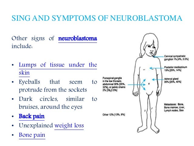 Neuroblastoma Patient Info On Symptoms Diagnosis And Treatment Opti