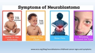 www.acco.org/blog/neuroblastoma-childhood-cancer-signs-and-symptoms
 
