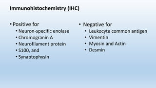 Immunohistochemistry (IHC)
•Positive for
• Neuron-specific enolase
• Chromogranin A
• Neurofilament protein
• S100, and
• Synaptophysin
• Negative for
• Leukocyte common antigen
• Vimentin
• Myosin and Actin
• Desmin
 