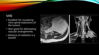 MRI
• Excellent for visualizing
intra-spinal extensions of
the tumors
• Also good for delineating
vascular arrangements
• Absence of radiation is a
benefit
 