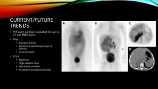 CURRENT/FUTURE
TRENDS
• PET scans are been evaluated for use vs
CT and MIBG scans
• Pros
• Indicates activity
• Excellent at identifying tissues of
interest
• Great contrasts
• Cons
• Expensive
• High radiation dose
• Not readily available
• Resolution and details still poor
 
