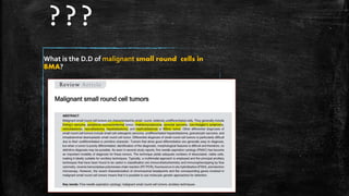 ???
What is the D.D of malignant small round cells in
BMA?
 