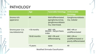 Shimada Classification neuroblastoma clinical features diagnosis and managemet | PPTX