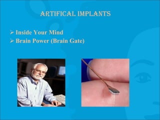 Artifical Implants Inside Your Mind Brain Power (Brain Gate) 