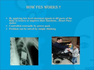 How fes works ? By applying low level electrical signals to dif parts of the body to restore or improve their functions…Heart Pace-maker Controlled externally by power pack Problem can be solved by simply thinking 