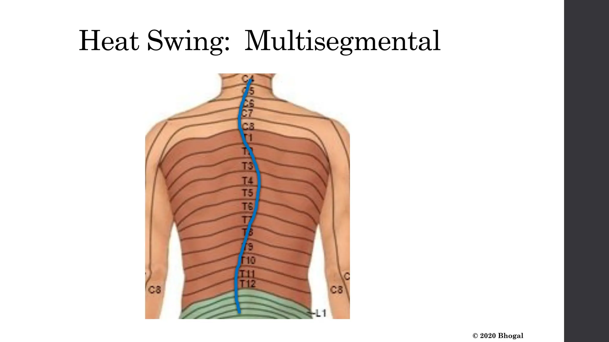 Ramneek Bhogal NeuroCare Presentation 2025.pdf
