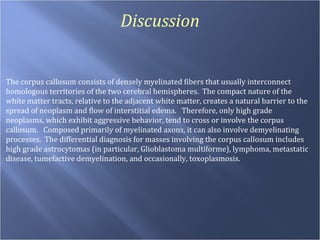Discussion The corpus callosum consists of densely myelinated fibers that usually interconnect homologous territories of the two cerebral hemispheres.  The compact nature of the white matter tracts, relative to the adjacent white matter, creates a natural barrier to the spread of neoplasm and flow of interstitial edema.  Therefore, only high grade neoplasms, which exhibit aggressive behavior, tend to cross or involve the corpus callosum.  Composed primarily of myelinated axons, it can also involve demyelinating processes.  The differential diagnosis for masses involving the corpus callosum includes high grade astrocytomas (in particular, Glioblastoma multiforme), lymphoma, metastatic disease, tumefactive demyelination, and occasionally, toxoplasmosis. 