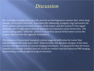 Discussion On radiologic imaging, they typically present as heterogeneous masses that, when large  enough, have central necrosis.  A peripherally enhancing, irregular ring represents the more cellular and vascularized portions of the tumor, and the central T1 low signal intensity and T2 high signal intensity portions correspond to areas of necrosis.  The classic radiographic “butterfly” pattern is caused by spread of the tumor across the corpus callosum into the opposite hemisphere.  The presence of associated vasogenic edema suggests infiltration by tumor that  extends beyond the bulk mass itself.  Unfortunately, the absolute margins of the mass are not well-appreciated on current imaging techniques.  It is purported that the lesion contains microscopic tendrils that are occult on routine contrast-enhanced MR imaging, necessitating a wide margin of surgical resection. 