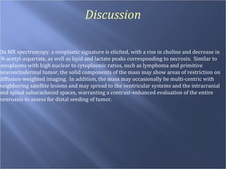 Discussion On MR spectroscopy, a neoplastic signature is elicited, with a rise in choline and decrease in N-acetyl-aspartate, as well as lipid and lactate peaks corresponding to necrosis.  Similar to neoplasms with high nuclear to cytoplasmic ratios, such as lymphoma and primitive  neuroectodermal tumor, the solid components of the mass may show areas of restriction on  diffusion-weighted imaging.  In addition, the mass may occasionally be multi-centric with  neighboring satellite lesions and may spread to the ventricular systems and the intracranial  and spinal subarachnoid spaces, warranting a contrast-enhanced evaluation of the entire  neuroaxis to assess for distal seeding of tumor. 