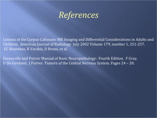 References Lesions of the Corpus Callosum: MR Imaging and Differential Considerations in Adults and  Children.  American Journal of Radiology  July 2002 Volume 179, number 1, 251-257.  EC Bourekas, K Varakis, D Bruns, et al. Escourolle and Poirier Manual of Basic Neuropathology:  Fourth Edition.  F Gray,  U De Girolami,  J Poirier. Tumors of the Central Nervous System. Pages 24 – 28. 