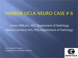 HARBOR UCLA NEURO CASE # 6 Anton Mlikotic, MD, Department of Radiology Marcia Cornford, MD, PhD, Department of Pathology   Los Angeles County Department of Health Sciences 