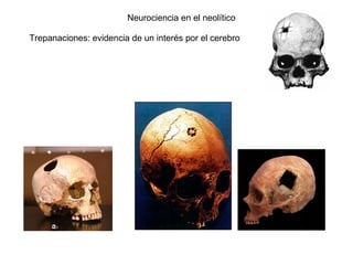 Neurociencia en el neolítico Trepanaciones: evidencia de un interés por el cerebro 