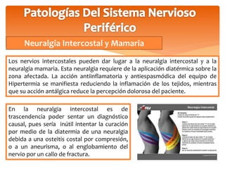 Neuralgia Intercostal y Mamaria 
Los nervios intercostales pueden dar lugar a la neuralgia intercostal y a la 
neuralgia mamaria. Esta neuralgia requiere de la aplicación diatérmica sobre la 
zona afectada. La acción antiinflamatoria y antiespasmódica del equipo de 
Hipertermia se manifiesta reduciendo la inflamación de los tejidos, mientras 
que su acción antálgica reduce la percepción dolorosa del paciente. 
En la neuralgia intercostal es de 
trascendencia poder sentar un diagnóstico 
causal, pues sería inútil intentar la curación 
por medio de la diatermia de una neuralgia 
debida a una osteitis costal por compresión, 
o a un aneurisma, o al englobamiento del 
nervio por un callo de fractura. 
 