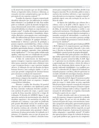 Rev Neurocienc 2007;15/3:211–218 216
original
mente para conseguir fazer os detalhes, devido à sua
fraqueza muscular. No seu desenho, pôde-se notar a
ausência dos membros inferiores, o que representa
uma alteração no seu esquema e imagem corporal35
,
podendo sugerir uma não aceitação do uso da ca-
deira de rodas.
As figuras dos indivíduos que relatam dor e
cãibras, como as de J.F.F. e B.C.G. (figuras 3 e 4,
respectivamente), foram realizadas na parte superior
da folha, de tamanho de pequeno a médio e com
ausência de movimento. A localização na folha pode
indicar a sensação de possuir objetivos inatingíveis, o
tamanho, sensação de inferioridade e a ausência de
movimento pode estar associada a posturas antálgi-
cas e à necessidade de permanecer imóvel devido à
presença de câimbras36
.
A alteração no traçado apresentada por J.M.D.
e R.F.L (figuras 5 e 6, respectivamente), que desenha-
ram os pés com um traçado rebuscado e não contí-
nuo, é descrita na literatura36
como uma busca por
estabilidade e possível perda da própria identidade.
O desenho feito pelos pacientes com ELA do
tipo bulbar apresentaram como única semelhança a
localização na parte central da folha. C.A.H. (figu-
ra 7) apresenta em seu desenho calvície, que associa
a apresentada por ele mesmo, e desvio da cabeça à
direita, com hemicorpo direito menor do que o es-
querdo, indicando instabilidade e/ou equilíbrio pre-
cário33
, e o desenho de L.N. (figura 8) foi realizado em
tamanho pequeno e em bloco, além de apresentar ao
seu lado o desenho de outra figura humana, demons-
trando timidez e sentimento de inferioridade35
.
O desenho de E.S. (figura 9) mostrou-se pobre
e próximo do “palito”, onde é difícil nomear cada
parte do corpo e é dada ênfase ao rosto, sugerindo
falta de percepção corporal e sensação de estar preso
em si mesmo, mantendo íntegras as funções cogniti-
vas. O maior destaque dado à cabeça é sugestivo de
sensação de inferioridade ou vergonha relacionada
às funções e partes do seu corpo32
.
O único desenho onde não se encontra alte-
ração do esquema e imagem corporal foi o realizado
por N.F. (figura 10), por ser rico em detalhes, sem
ausência de partes do corpo, com movimento, tama-
nho e proporções adequados, apresentando pequena
diferença entre os membros inferiores, onde há um
destaque para o membro inferior esquerdo, no qual
relata cãibras freqüentes. A presença de movimento
indica adaptação e capacidade mental35
. O indiví-
duo apresenta pouco tempo de evolução da doença,
o que pode justificar que, apesar do seu comprome-
se dá através das sensações que nos são percebidas.
Temos as impressões táteis, térmicas e dolorosas, as
sensações viscerais e proprioceptivas, que nos dão a
percepção de um esquema corporal17, 29
.
A análise do esquema e imagem corporal pode
identificar alterações que vão influenciar na motrici-
dade voluntária e na qualidade de vida. Essa análise
pode ser realizada a partir do desenho da figura hu-
mana, demonstrando através dele a maturidade con-
ceitual do indivíduo em relação ao corpo humano e o
próprio corpo30
. A análise da imagem corporal apon-
ta para prejuízos relacionados à insatisfação, depre-
ciação, distorção e preocupação com a auto-imagem,
todos eles influenciados por fatores sócio-culturais31
.
Durante a realização de qualquer desenho, é
fundamental se observar o processo de produção: a
postura corporal, a motricidade fina, o ritmo e a forma
de elaborar as figuras e a cena. São relevadas as inca-
pacidades apresentadas durante a criação do desenho,
sendo aceitas quaisquer expressões como profunda-
mente significativas23,32
. Um traço gráfico isolado nada
significa, cada traço deve ser considerado em conexão
com os demais e no contexto geral do desenho30,33
.
A falta de conhecimento do fisioterapeuta
quanto à imagem e esquema corporal dos pacientes
talvez possa aumentar ainda mais a distância entre
o que o terapeuta deseja e o que o paciente imagina
oferecer. A utilização do teste do desenho da figura
humana favorece uma avaliação rápida e é um re-
curso que permite comparação de amostras futuras
para mensurar a evolução do tratamento34
.
A análise individual e em grupo dos desenhos
pode ilustrar o impacto das seqüelas e alterações que
a doença ELA pode trazer ao esquema e imagem
corporal desses indivíduos.
Durante a análise dos desenhos, foi possível
observar que os indivíduos com significativa perda
da força muscular realizaram desenhos grandes e
com ausência de partes do corpo, e quanto maior
a perda da força muscular, menor foi o tempo de
realização. O desenho de A.M.R.O. (figura 1), que
apresenta ausência da movimentação ativa distal de
membros superiores e do movimento de pinça, foi
realizado em 2 minutos, o que pode ser justificado
pela grande dificuldade motora de membros supe-
riores, não apresentando detalhes e sendo realizado
de maneira contínua. Já o desenho de E.F.S. (figu-
ra 2), com movimentação ativa proximal e distal e
movimento de pinça preservados, foi realizado em 4
minutos e 45 segundos, uma vez que ele possui me-
lhor habilidade motora e realizou o desenho lenta-
 