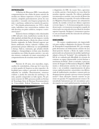 Rev Neurocienc 2007;15/3:251–253 252
relato de caso
INTRODUÇÃO
A Doença de Hirayama (DH) é marcada pelo
comprometimento das células da ponta anterior da
medula nos últimos segmentos cervicais e primeiro
torácico, atingindo particularmente jovens do sexo
masculino e cursando com fraqueza progressiva da
mão e antebraço, unilateral na maioria dos pacien-
tes1-3
. Foi relatada primeiramente em 1959 e, desde
então, indivíduos com características similares têm
sido descritos em países asiáticos, europeus e norte-
americanos4-5
.
Inúmeros fatores etiológicos estão relacionados
à DH: infecções virais, insuficiência vascular da me-
dula espinhal, atividade física de alto impacto e atrofia
focal da medula durante a flexão da coluna cervical.
Estudos originados da Índia Oriental sugerem que
fatores ambientais, étnicos, culturais e hábitos com-
portamentais possam influenciar na susceptibilidade
à doença. Sabe-se, entretanto, que achados eletrofi-
siológicos e histopatológicos revelam uma desordem
neurogênica nas células da ponta anterior e nos axô-
nios motores, resultando em sinais característicos de
comprometimento do neurônio motor inferior3,6
.
CASO
Paciente de 20 anos, sexo masculino, negro,
auxiliar de controladoria, relata que há 4 anos deu-
se início quadro de fraqueza na mão esquerda e di-
ficuldade para realizar a preensão de instrumentos
utilizados no trabalho. Posteriormente, tornou-se
evidente a atrofia dos músculos do antebraço e da
mão, quando comparados ao lado oposto. No pri-
meiro semestre de 2003, procurou auxílio no Serviço
de Neurologia (Setor de Doenças Neuromusculares)
da Universidade Federal Fluminense, recebendo
o diagnóstico de DH. Ao exame físico, apresenta-
va atrofia, paresia e fasciculações no terço distal do
membro superior esquerdo. Os reflexos profundos
encontravam-se normais, com exceção do flexor dos
dedos (arreflexia à esquerda). O exame de Ressonân-
cia Magnética Funcional apontou um achatamento
(atrofia) da medula cervical nos últimos segmentos
cervicais (figura 1). A eletroneuromiografia mostrou
desnervação e recrutamento neurogênico seguido de
reinervação nos músculos do terço distal do membro
superior esquerdo. Na figura 2, mostramos o pacien-
te com acentuada atrofia dos músculos do antebraço
e da mão à esquerda.
DISCUSSÃO
Os exames complementares são imprescindí-
veis para auxiliar o diagnóstico da doença. O exame
de Tomografia Computadorizada (TC), por exemplo,
pode demonstrar um deslocamento anterior do saco
dural posterior durante a flexão da região cervical,
provocando um achatamento da medula espinhal que
adquire a forma de “berinjela”1
. Já a mielografia é di-
fícil de ser realizada pela dificuldade de retenção do
contraste no espaço subaracnóide cervical durante o
movimento de flexão7
. Entre os métodos, o processa-
mento de Imagem de Ressonância Magnética (IRM)
mostra o deslocamento anterior do saco dural pos-
terior e um secundário congestionamento do plexo
venoso epidural posterior, característica esta diferen-
ciada de malformações vasculares e tumores pelo seu
desaparecimento quando o pescoço retorna à posição
neutra4,8
. Essas alterações estavam ausentes no pa-
ciente em questão. O congestionamento venoso é de-
sencadeado basicamente por três mecanismos: pres-
são negativa no canal espinhal posterior resultante do
Figura 1. Atrofia da medula cervical nos últimos segmentos. Figura 2. Atrofia no membro superior esquerdo.
 