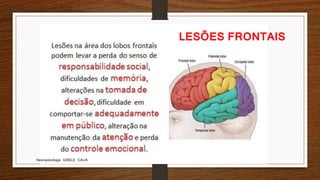 Neuropsicóloga GISELE CALIA
LESÕES FRONTAIS
 