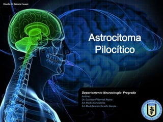 Astrocitoma
      Pilocítico



Departamento Neurocirugía Pregrado
Autores:
Dr. Gustavo Villarreal Reyna
Est Med Ulises Gloria
Est Med Ricardo Treviño García
 