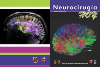 Neurocirugía Hoy, Vol. 4, Numero 16