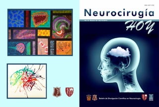 Neurocirugía Hoy, Vol. 10, Numero 29
