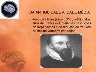 DA ANTIGUIDADE A IDADE MÉDIA
• Ambroise Paré (século XVI , médico dos
Reis da França) – Excelentes descrições
de trepanações e de redução de fraturas
da coluna vertebral por tração.
 