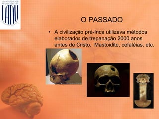 O PASSADO
• A civilização pré-Inca utilizava métodos
elaborados de trepanação 2000 anos
antes de Cristo. Mastoidite, cefaléias, etc.
 