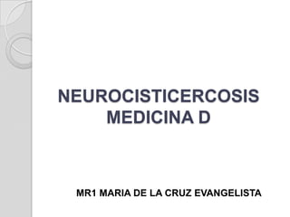 NEUROCISTICERCOSIS
    MEDICINA D



 MR1 MARIA DE LA CRUZ EVANGELISTA
 